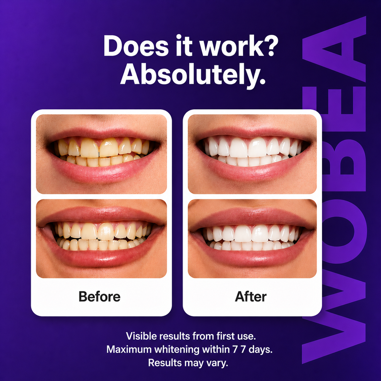 Wobea Purple Teeth Whitening Strips™